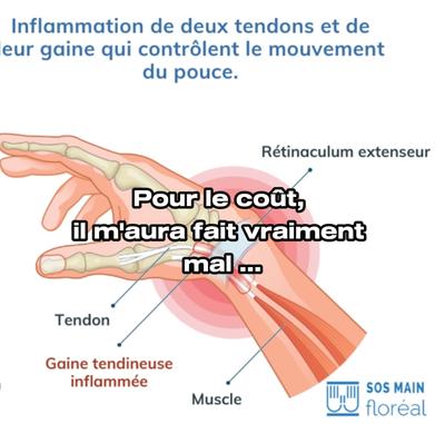 aïe aïe aïe